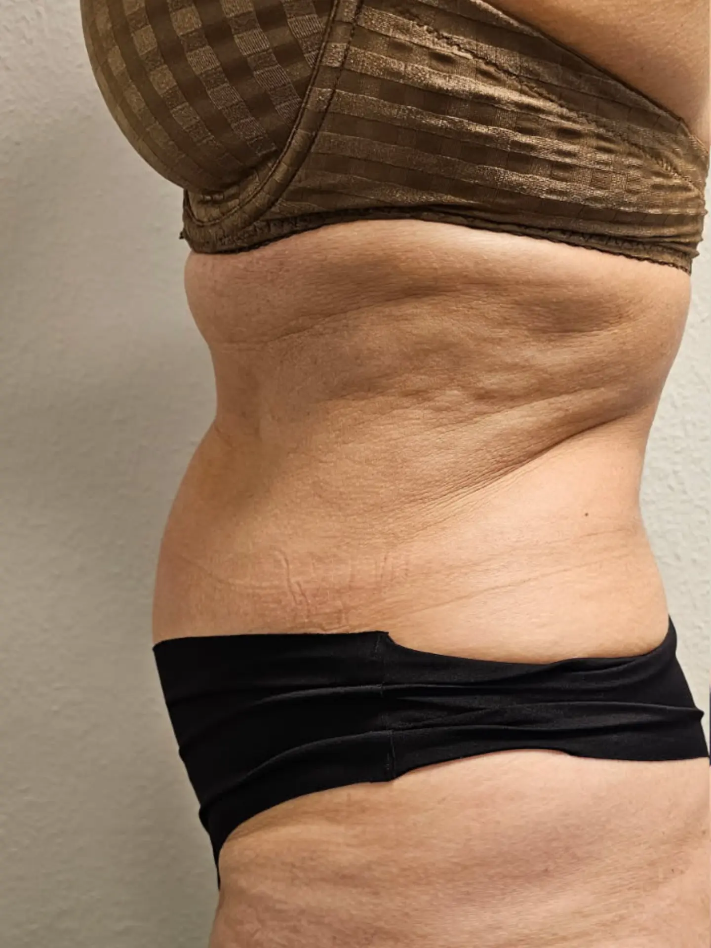 SIDEPROFIL — efter