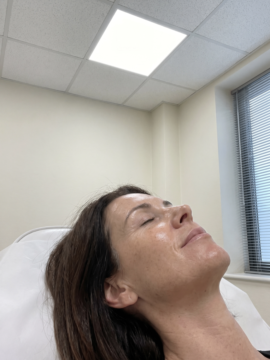 Cool Lifting / Japansk Lifting-behandling hos Beautiful Balance
